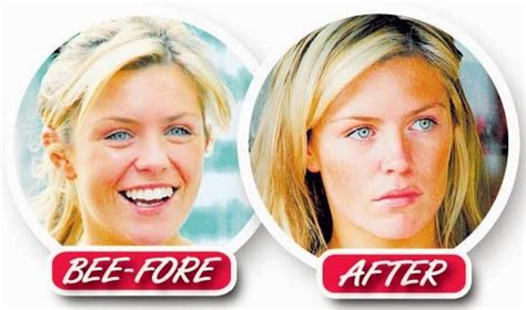 abbey clancy programme|abbey clancy before and after.